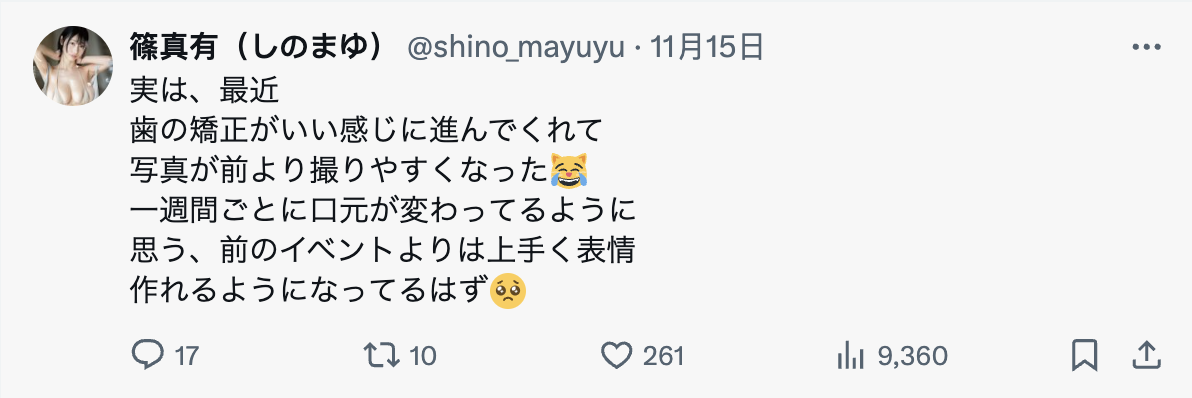 矫正牙齿中！史上最强隐藏巨乳、最细JCup的她要变性感女神？-图片4